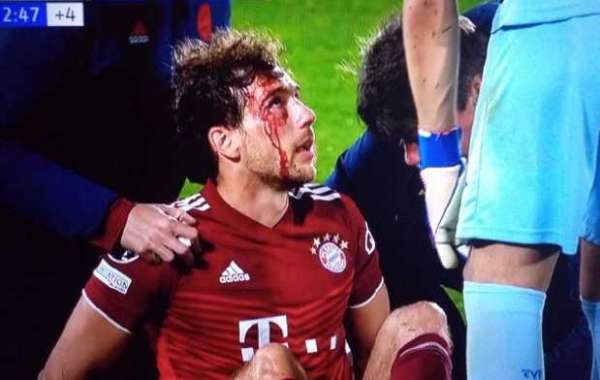 Kan ikke holde ud at se det! Bayerns midtbanespiller har blod i ansigtet efter at være blevet albuet